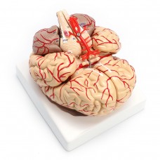 Brain with Arteries, 2 Parts